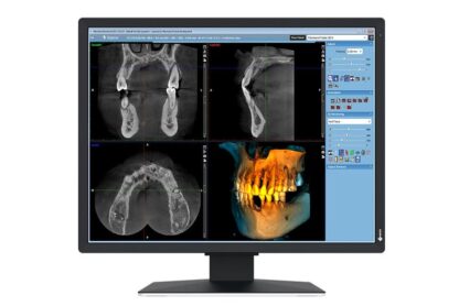Monitor Eizo 21" MX217-SB - Image 9